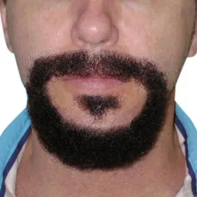'Marco' - Circle Beard